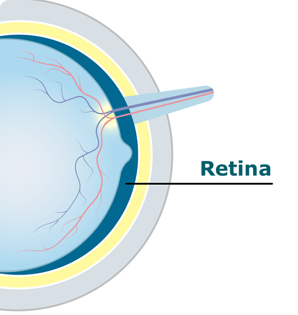 Eye diagram showing the retina