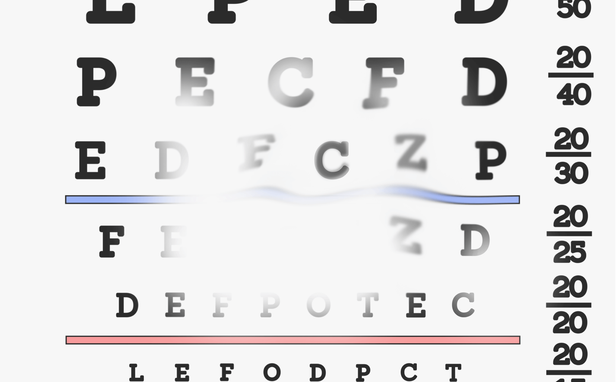 Eye chart: GA through a patient's eyes at diagnosis